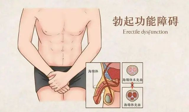 图片41