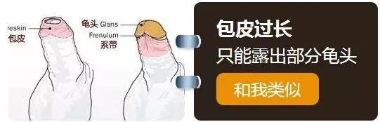 图片15.png